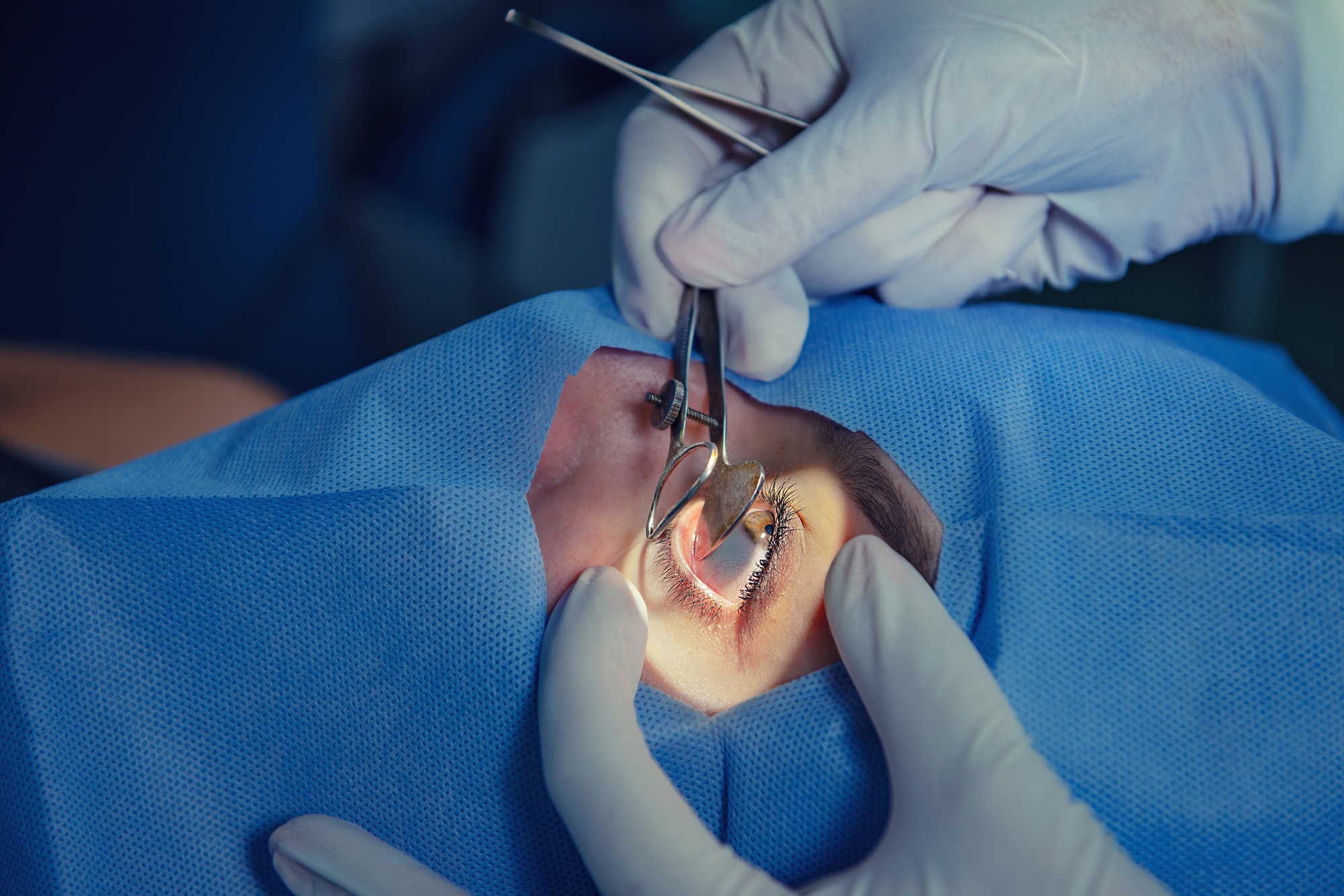 Operating room. Eye surgery